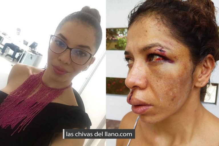 Lina Ramirez, golpeada brutalmente por un amigo