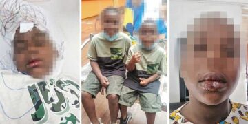 Boyacá: docente denunció aterrador caso de violencia racista