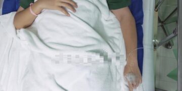 Meta: una mujer resultó lesionada por pólvora en Guamal