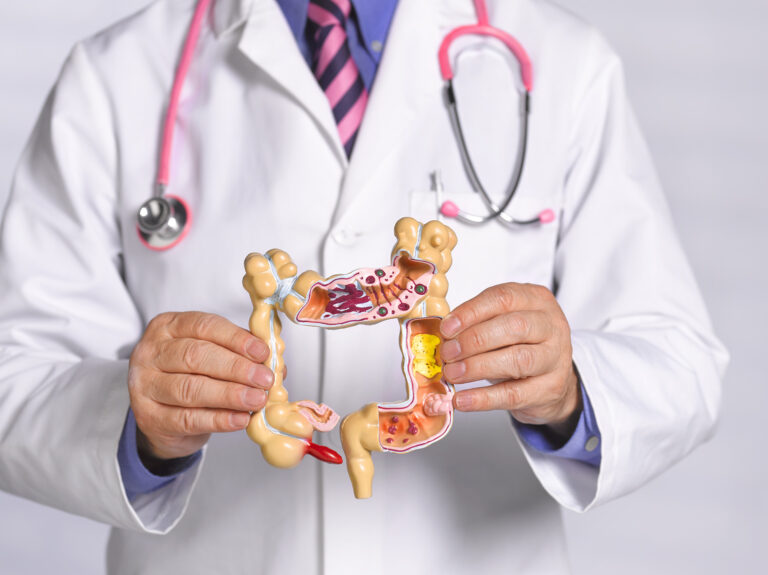Doctor holding Common pathologies anatomical model