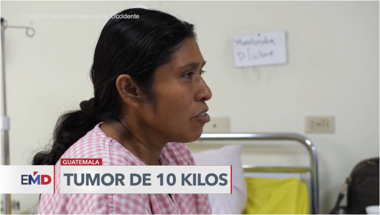 Extraen tumor a embarazada en Guatemala